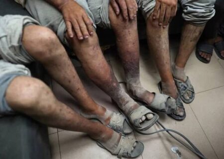 غزہ کے ناصر ہسپتال کے ڈائریکٹر ڈاکٹر احمد الفرا کا دل دہلا دینے والا بیان